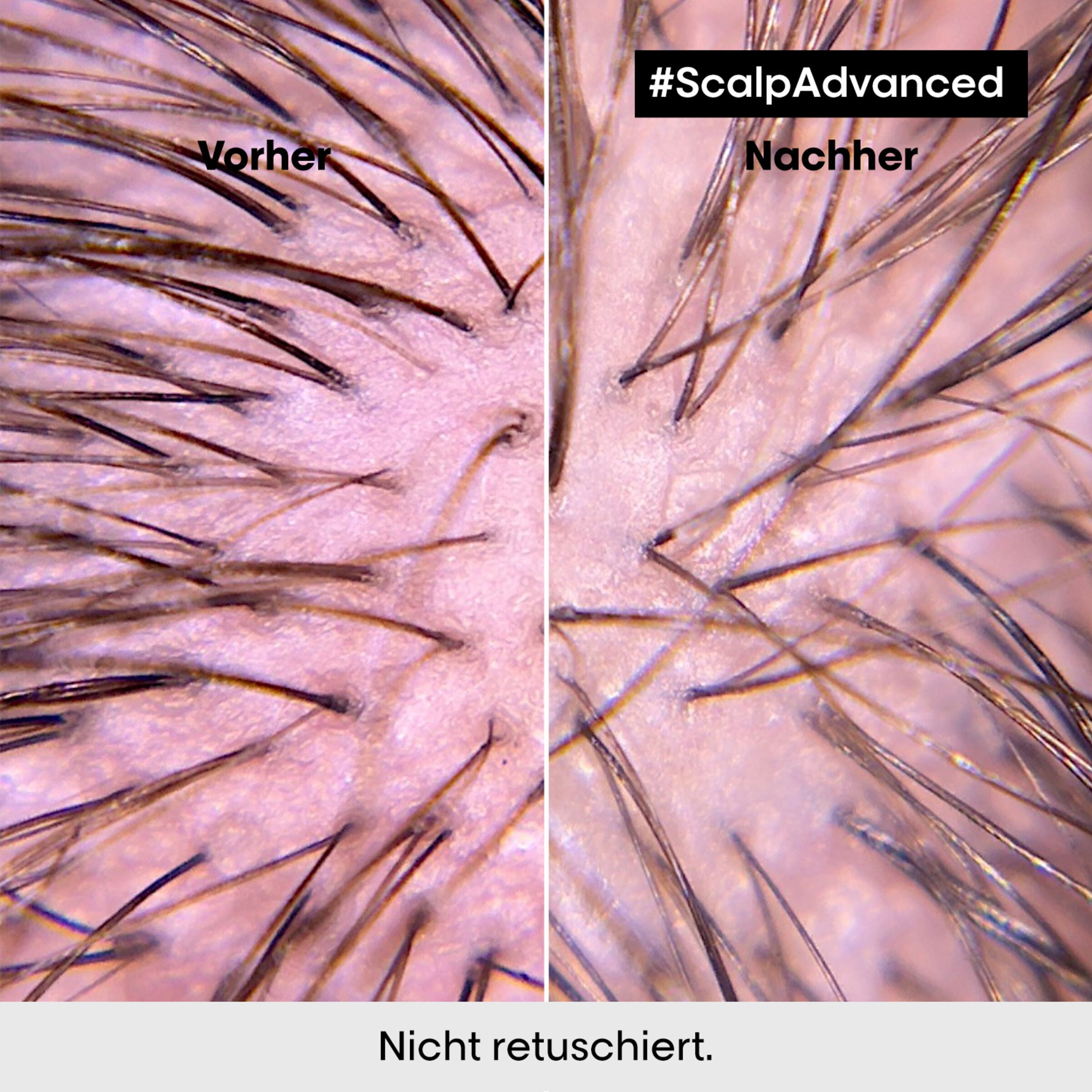 Scalp Advanced Anti-Discomfort Intense Soother Treatment 200 ml