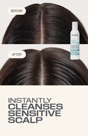 Dualsenses Scalp Specialist Sensitiv Schaum Shampoo 250 ml