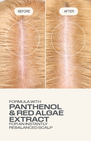 Dualsenses Scalp Specialist Rebalance & Feuchtigkeits Fluid 150 ml