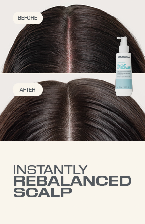 Dualsenses Scalp Specialist Rebalance & Feuchtigkeits Fluid 150 ml